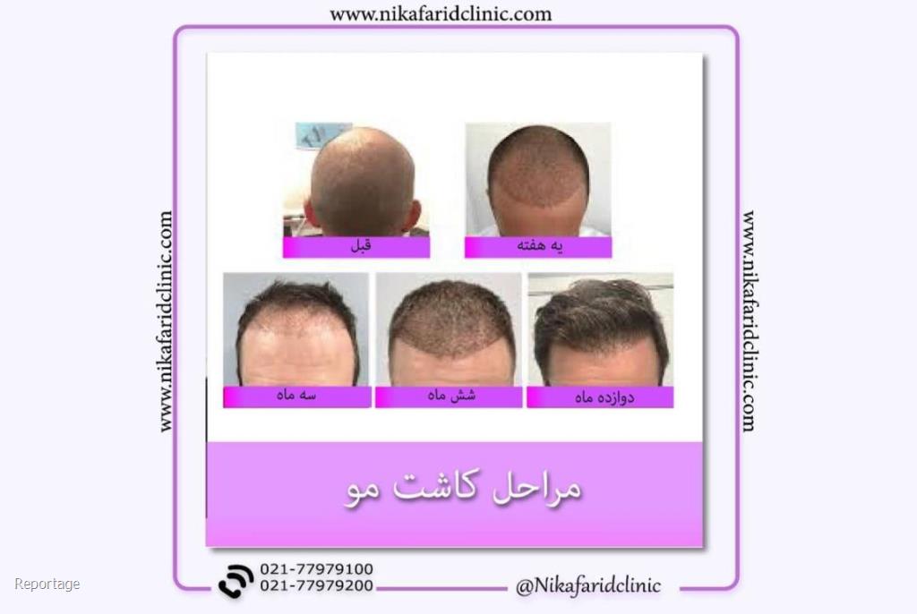 کلینیک پوست و مو نیک آفرید
